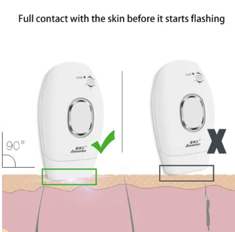 300.000 Pro Permanent IPL Laser
